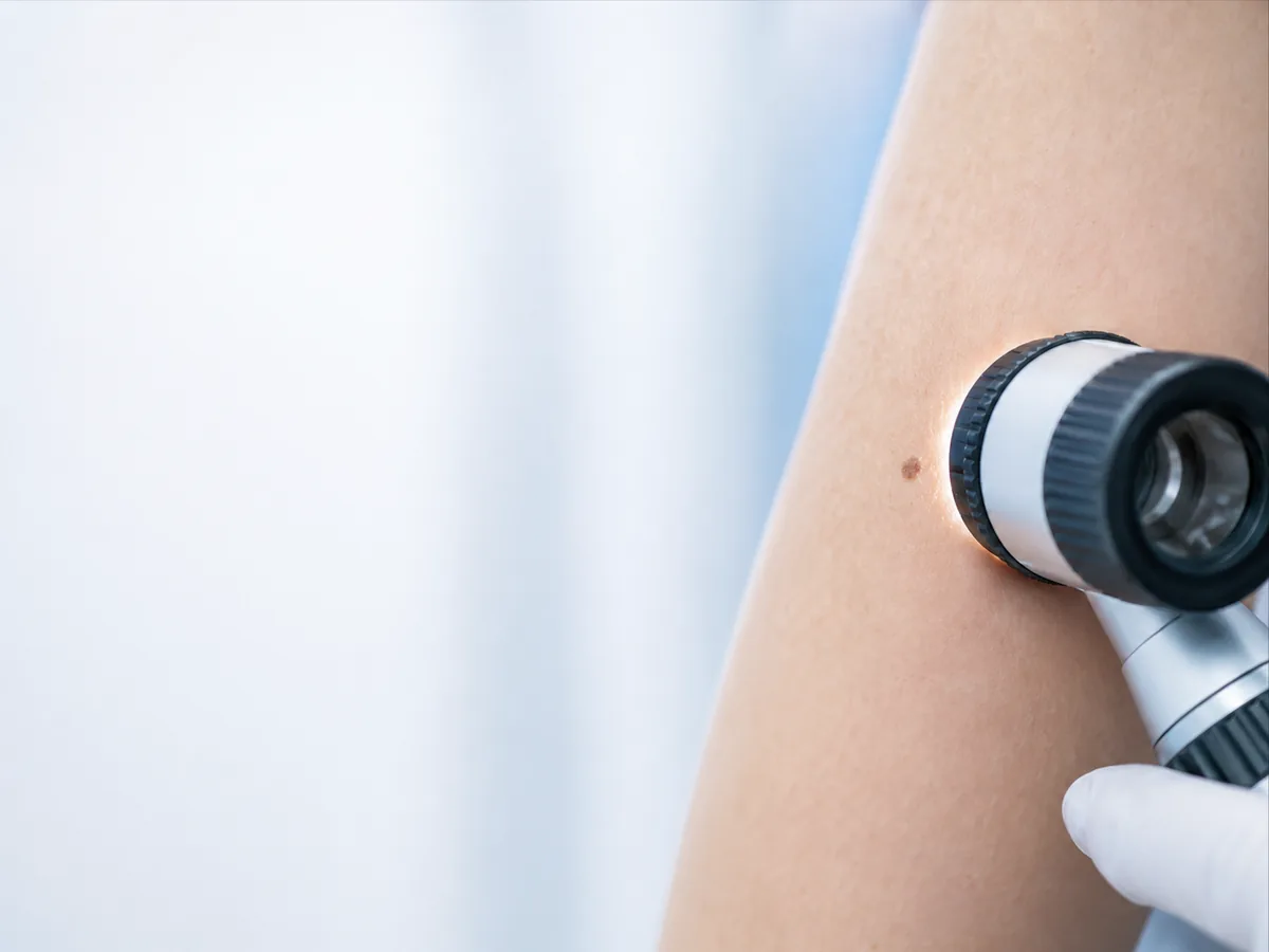 Consultation de chirurgie dermatologique — photographie d'illustration