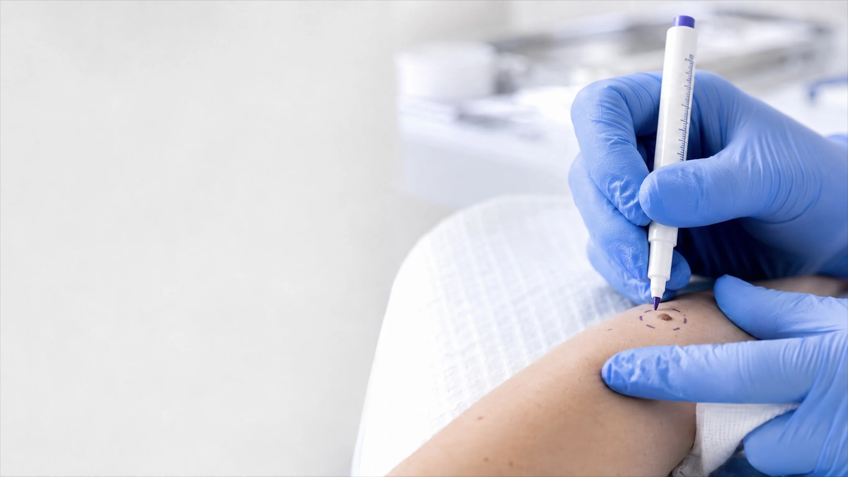 Peau de l'épaule et du cou dans un cadre clinique — chirurgie dermatologique